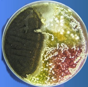 Mold and Yeast Growing on Petri Dish